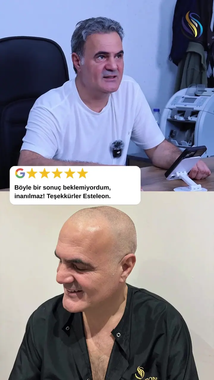 Ali Bey - 7 aylık gelişim