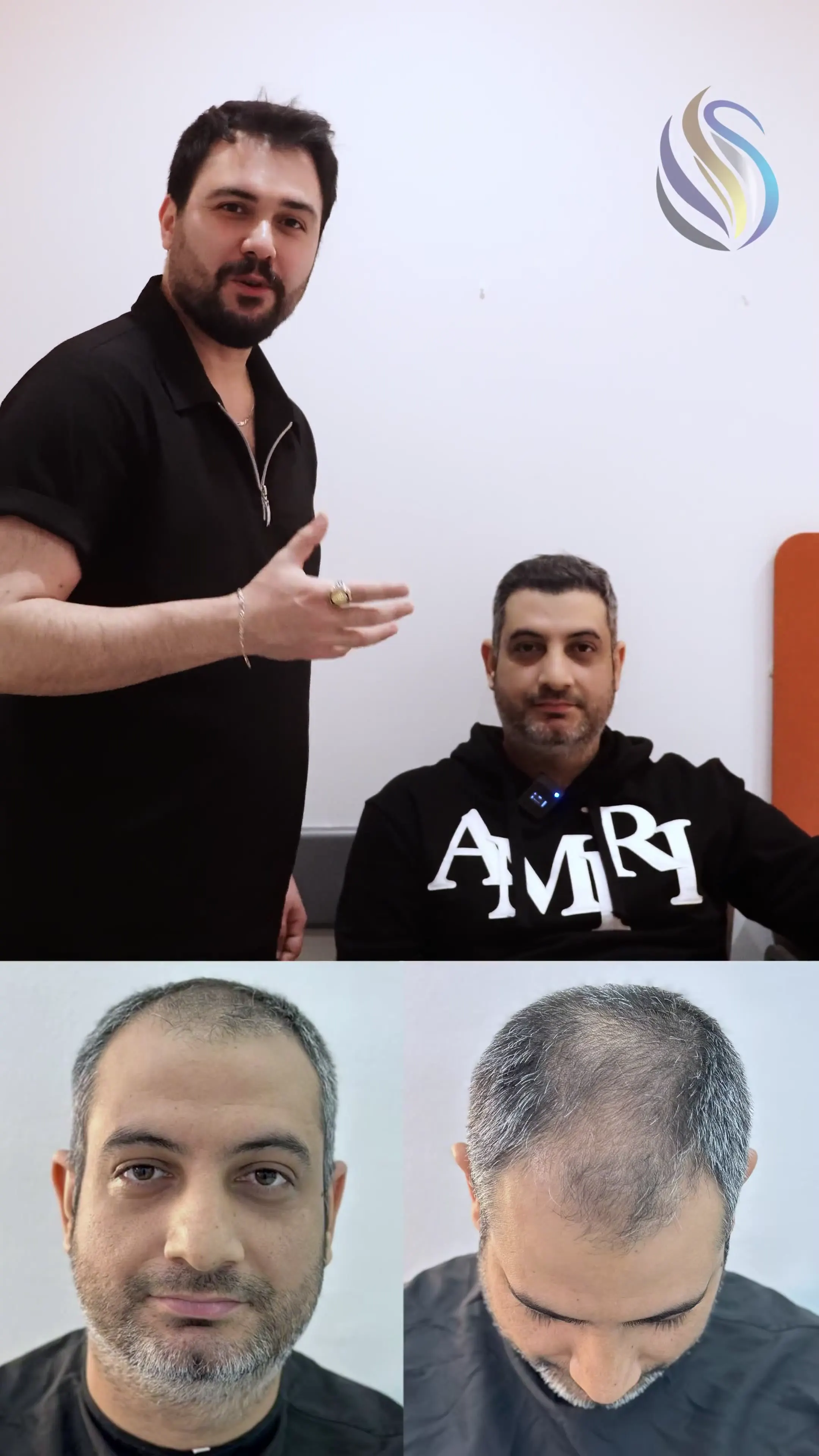 Leon Hair Turkey hasta sonucu